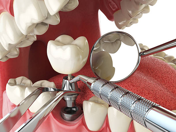 Professional Emergency Dental Service in SC