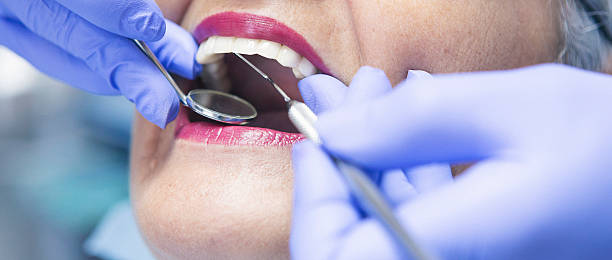 Best Dental Abscess Treatment in City View, SC